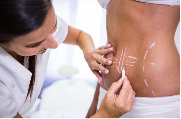 Understanding Tummy Tuck Abdominoplasty and the Recovery Process